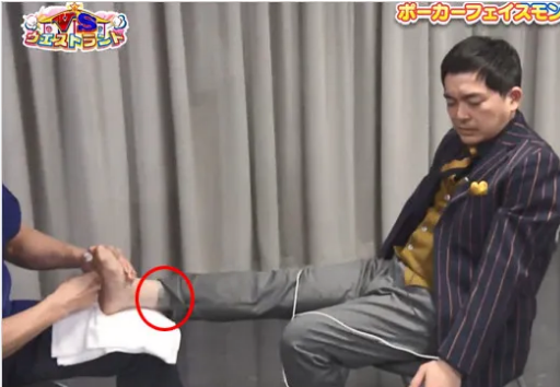 河本太　タトゥ　治療